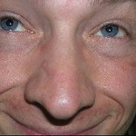 Aldas, 51